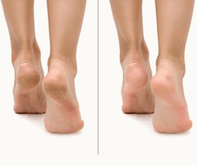 Fotfil med två sidor